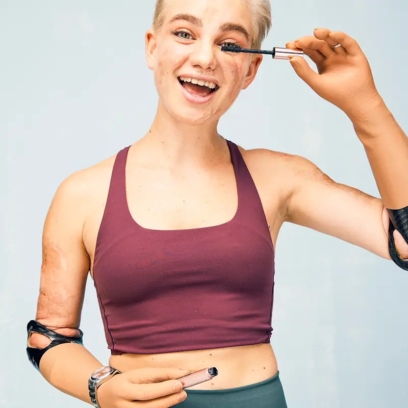 Bebe Vio aus Italien ist Paralympics-Goldmedailliengewinnerin im Rollstuhl-Fechten, Autorin und Moderatorin.