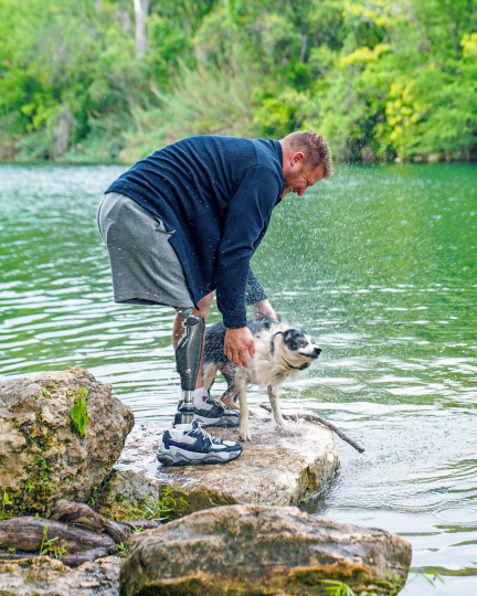 An Ottobock prosthetic leg user enjoys time outdoors by a lake with his dog. He bends down on a rock to pet the wet dog, smiling in a natural, playful moment.