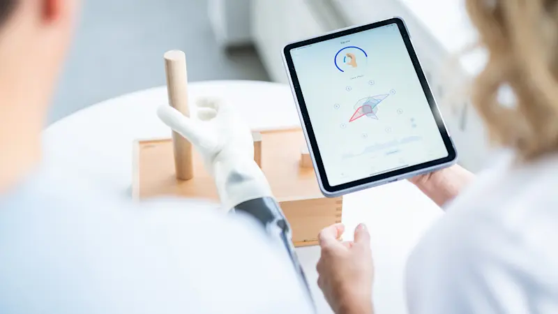 Two individuals, one with a bionic arm, are viewing a tablet to monitor, train and control the myoelectric hand prosthesis.