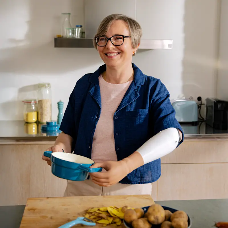 Frau kocht mit Handprothese.