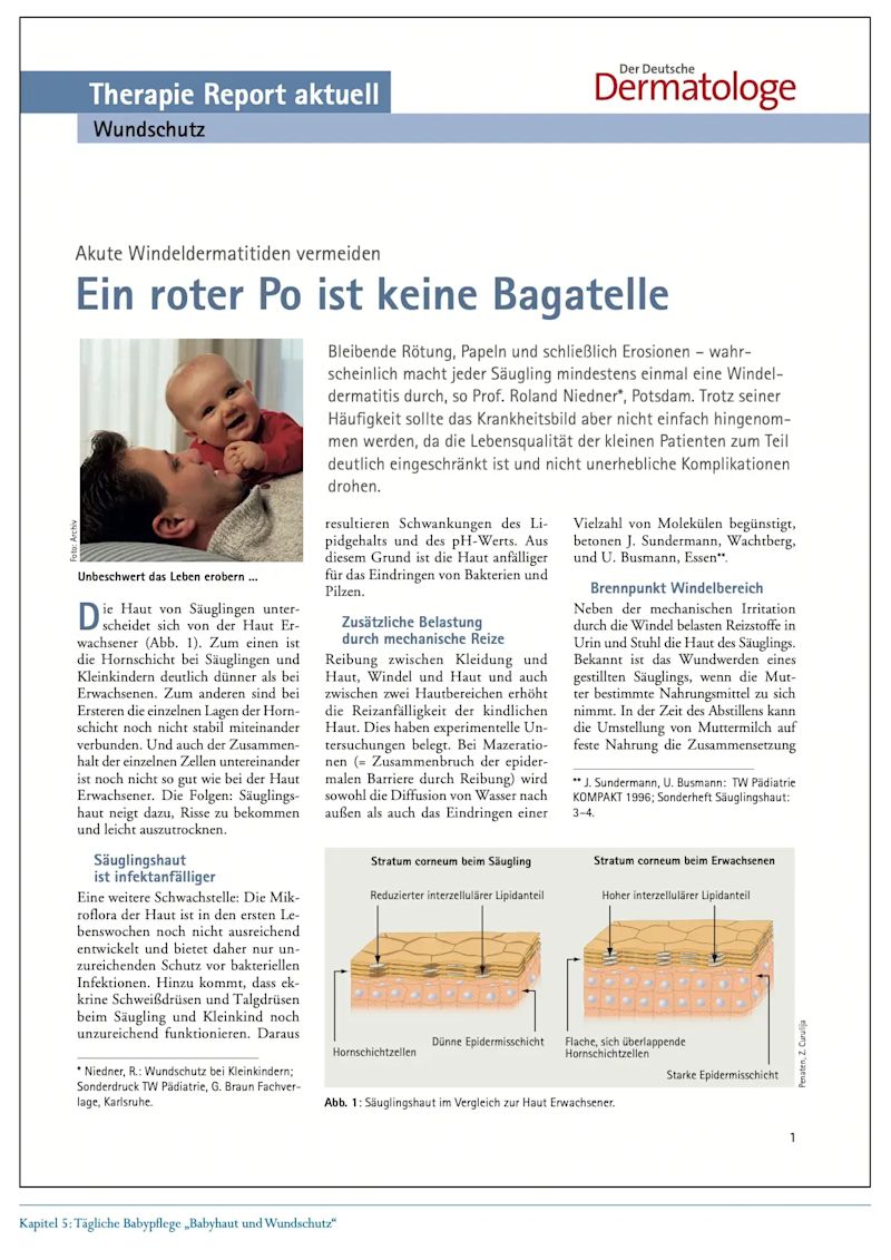 EIN ROTER PO IST KEINE BAGATELLE