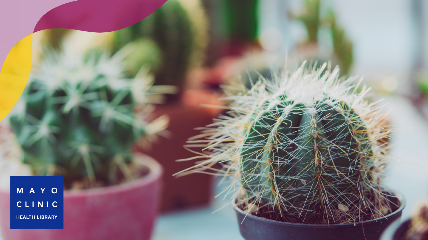 Several cactus plants in pots.