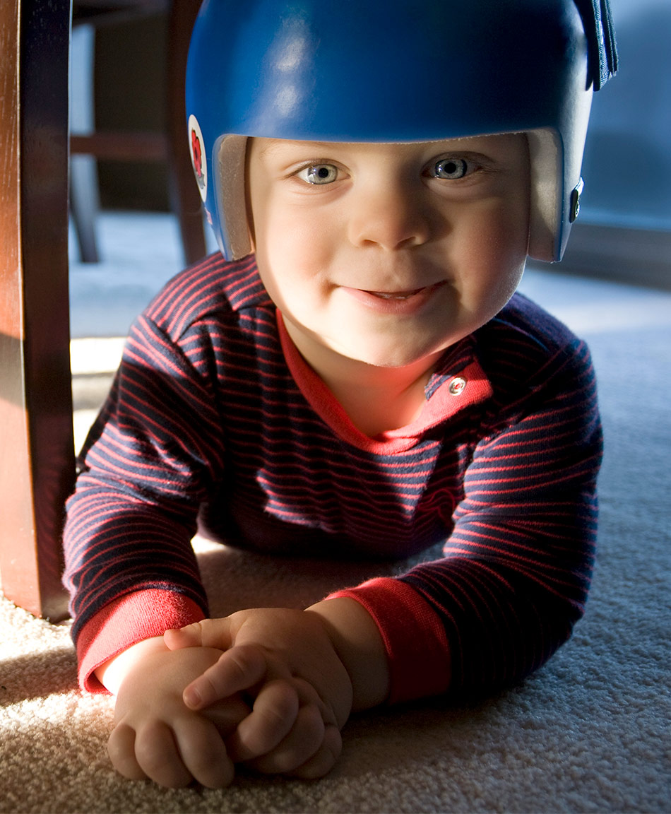 Baby has flat spot best sale on right side of head