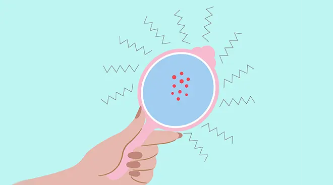 Illustration of mirror with acne spots.