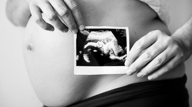 pregnant woman holding sonogram