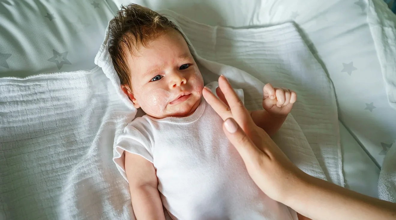 mother applying cream to eczema on baby's face