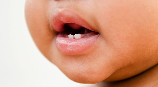 Close-up of baby's mouth with a couple of teeth.