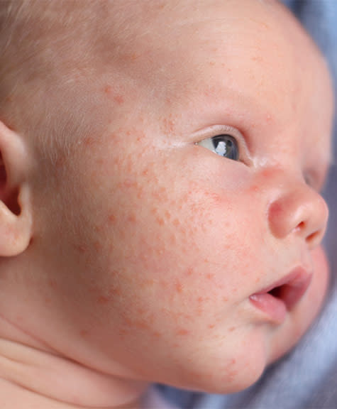 Baby's Skin: Smooth but Sensitive! - Positive Parenting