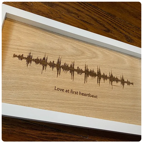 SimpleNeedThis Love at First Heartbeat