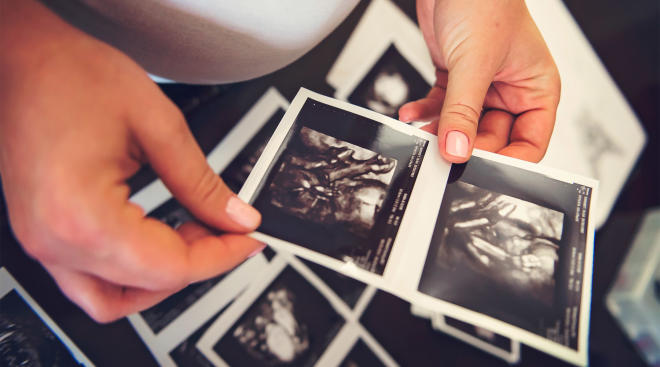 pregnant woman holding several sonograms of her baby