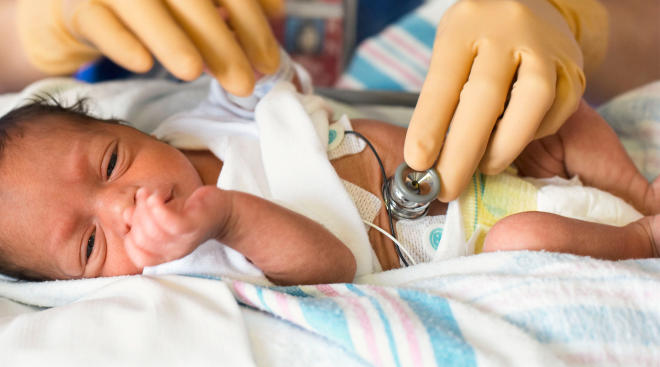 preemie baby in the hospital being cared for by doctor