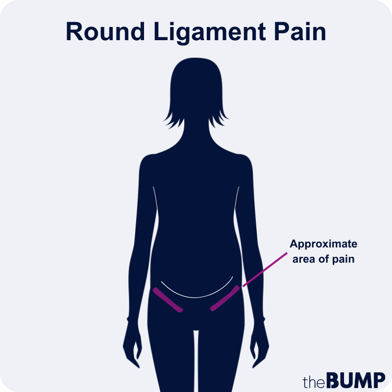 Round Ligament Pain Stretches to Use Right Now
