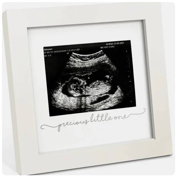 KeaBabies Solo Baby Sonogram Frame