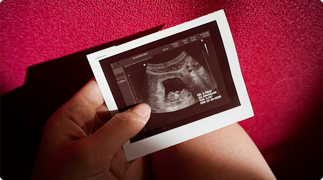 ultrasound photo of early pregnancy