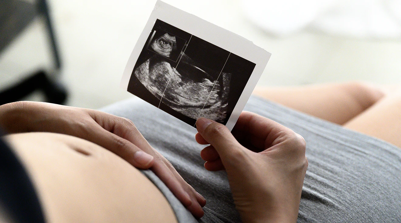 What to Know About the Nuchal Translucency Ultrasound picture