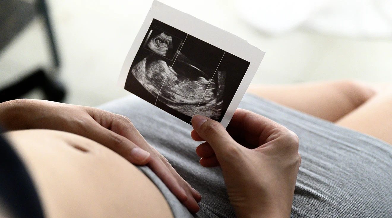 pregnant woman holding photo of ultrasound