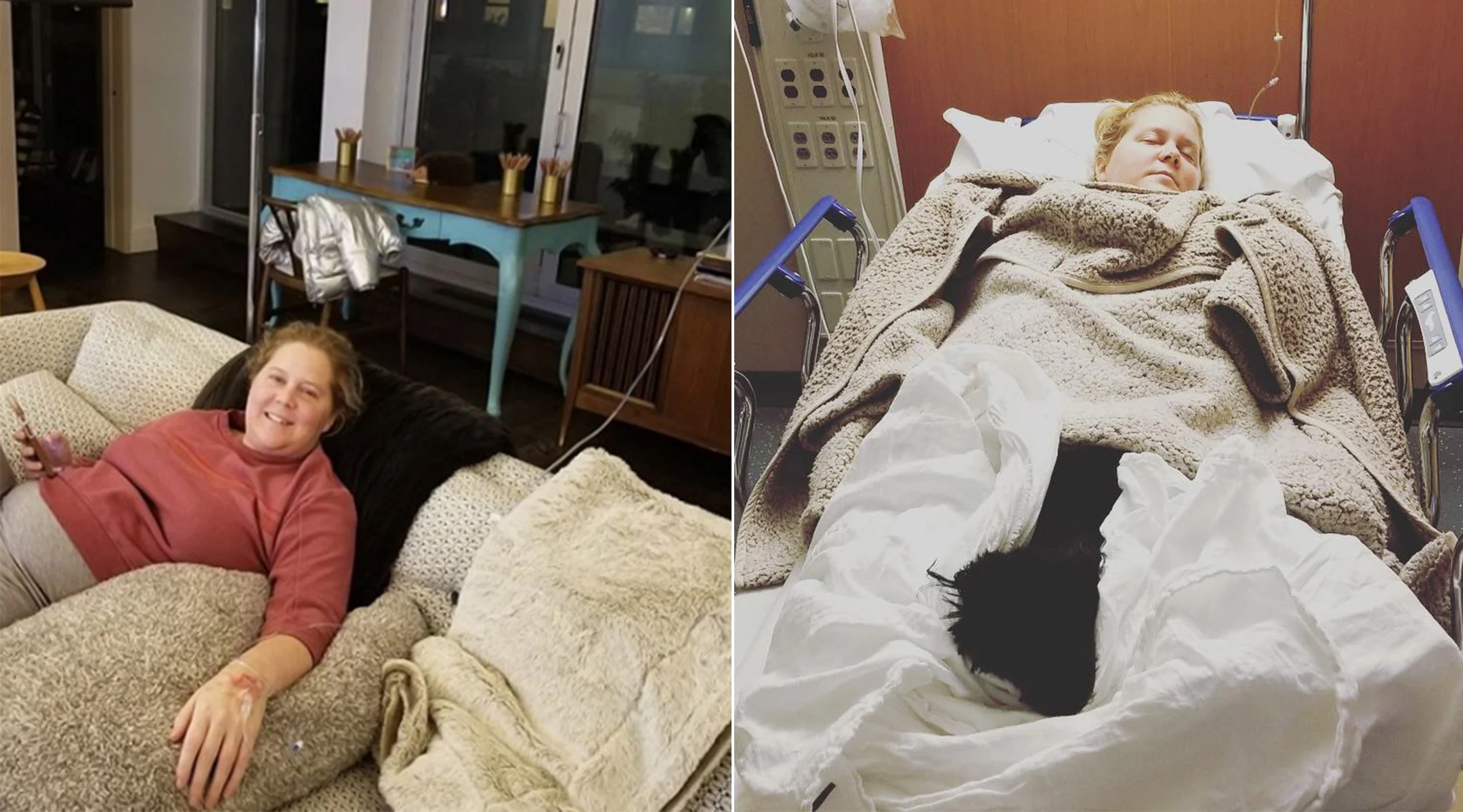 amy schumer opens up about her hyperemesis gravidarum during pregnancy