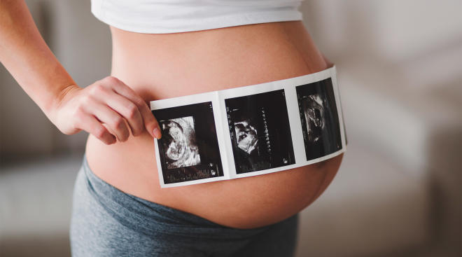 pregnant woman holding sonogram
