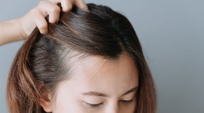 Your Guide to Dealing With Postpartum Hair Loss
