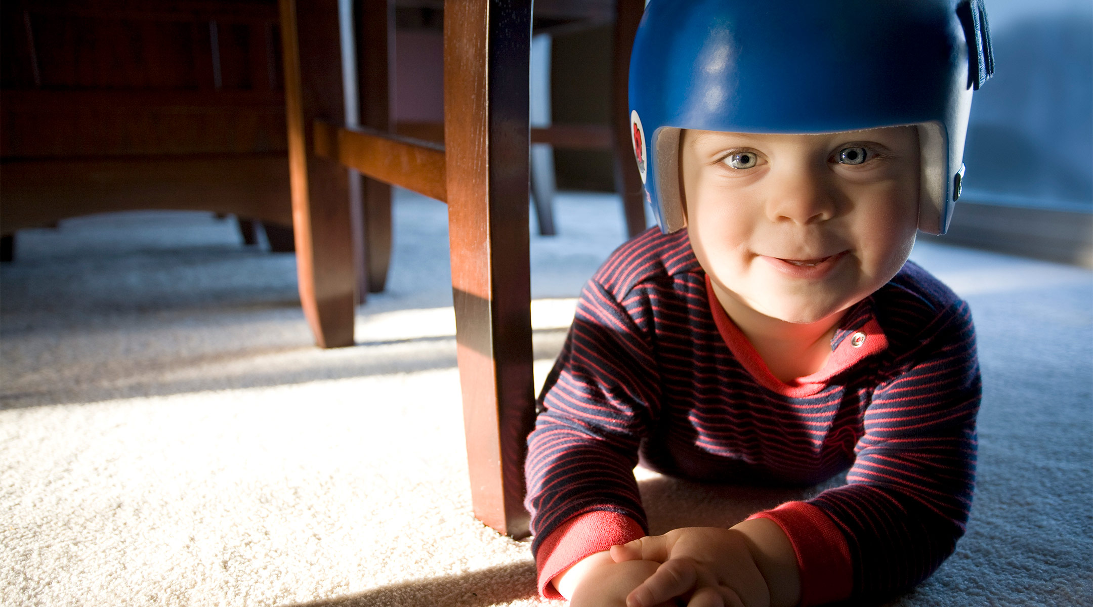 happy baby wearing corrective helmet