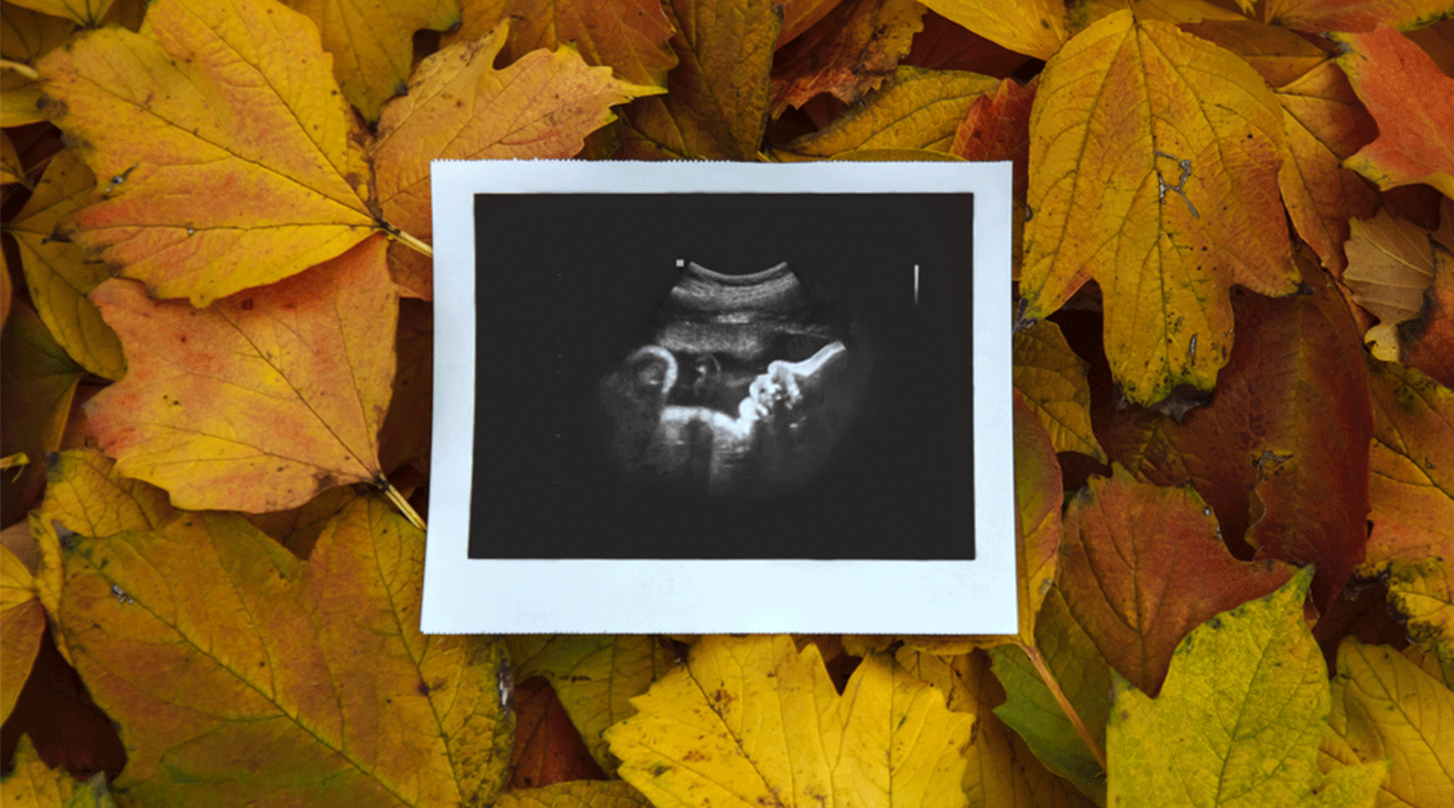 pregnancy ultrasound photo on fall leaves