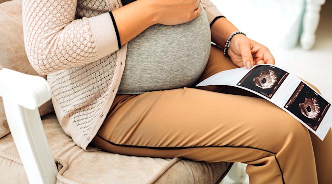 pregnant woman holding her sonogram