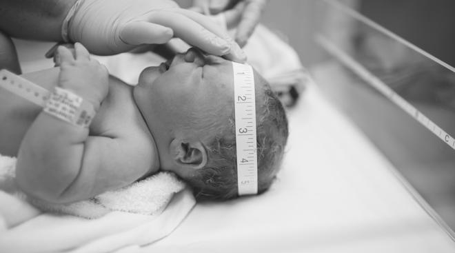newborn head circumference measured growth
