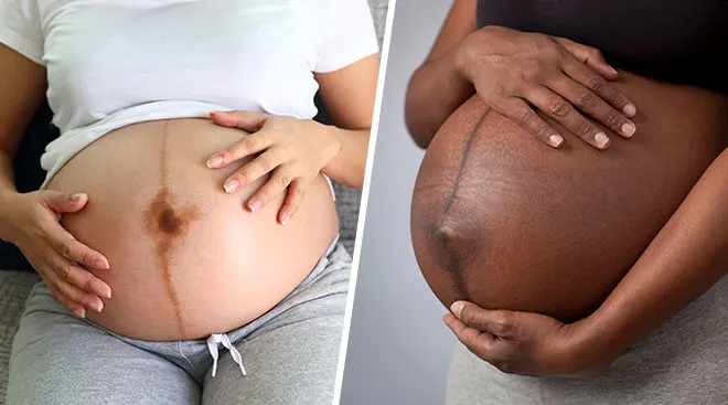 6 Reasons you have a bigger pregnant belly