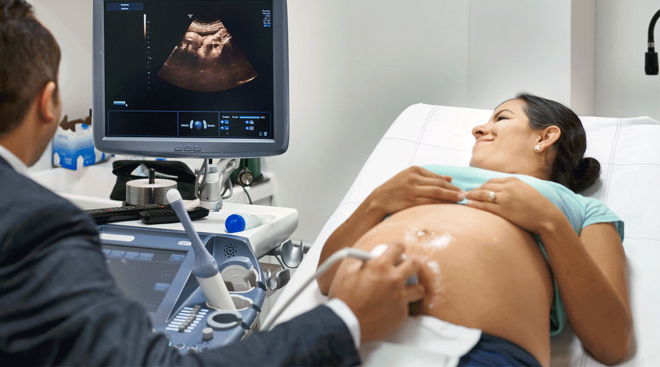  SUUEKRE Doppler Fetal Monitor Heartbeat Baby Heartbeat