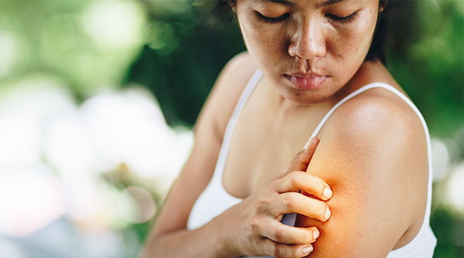 woman scratching her arm