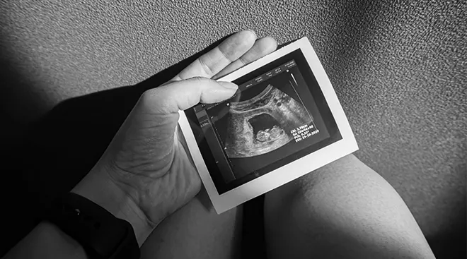person holding ultrasound photo