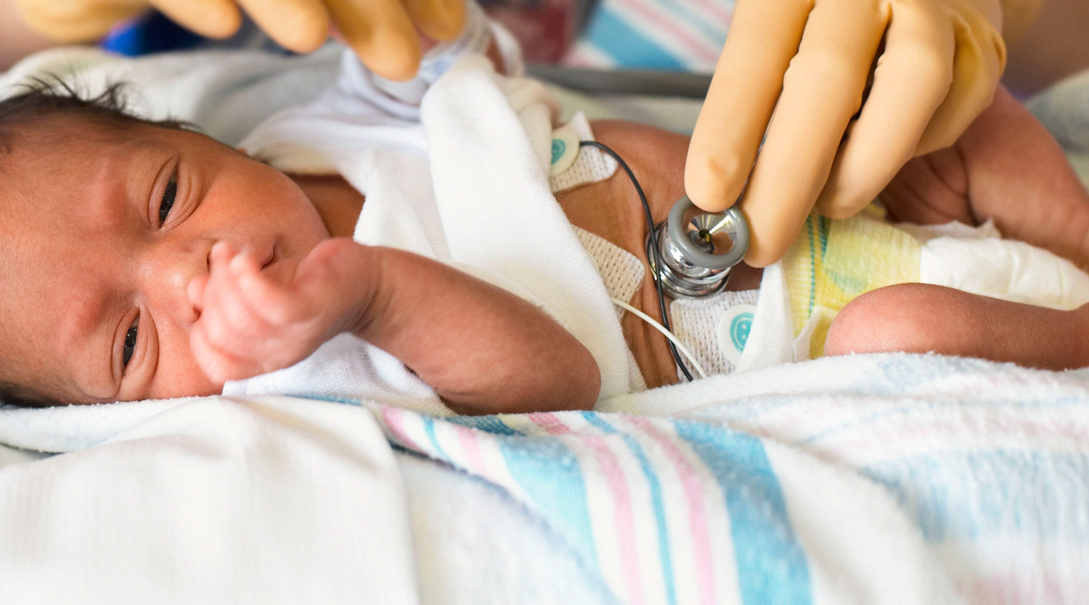 preemie baby in hospital being tended by doctor