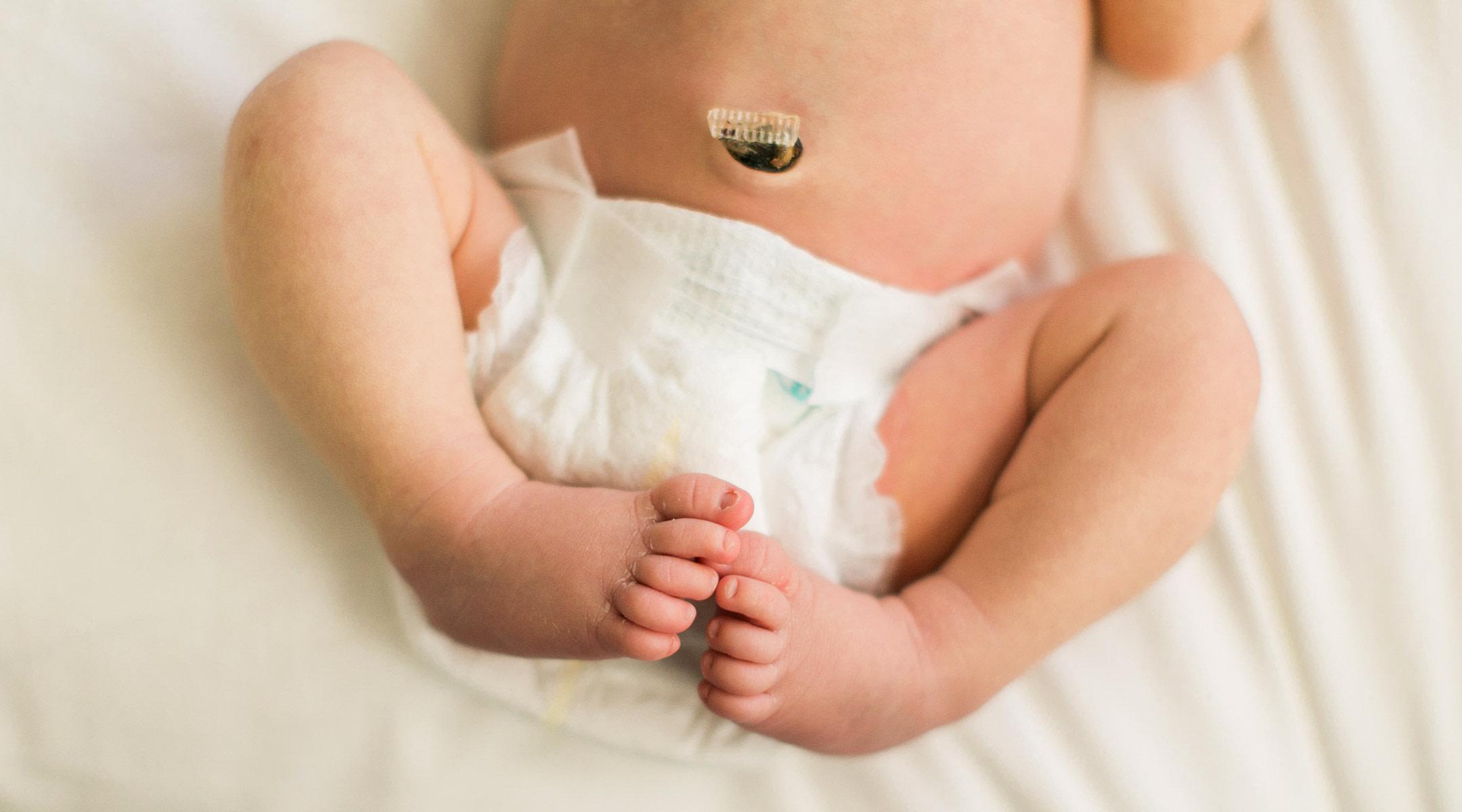 newborn with umbilical cord stump