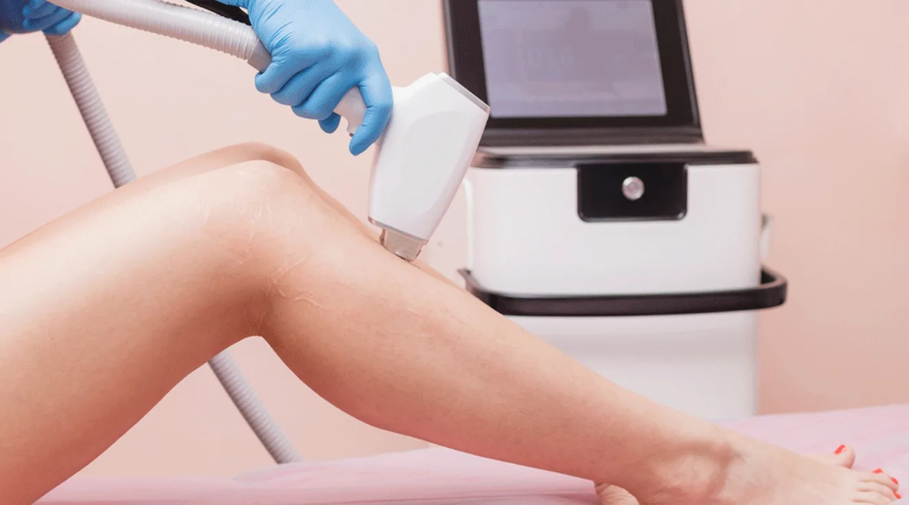 laser hair removal device on woman's leg