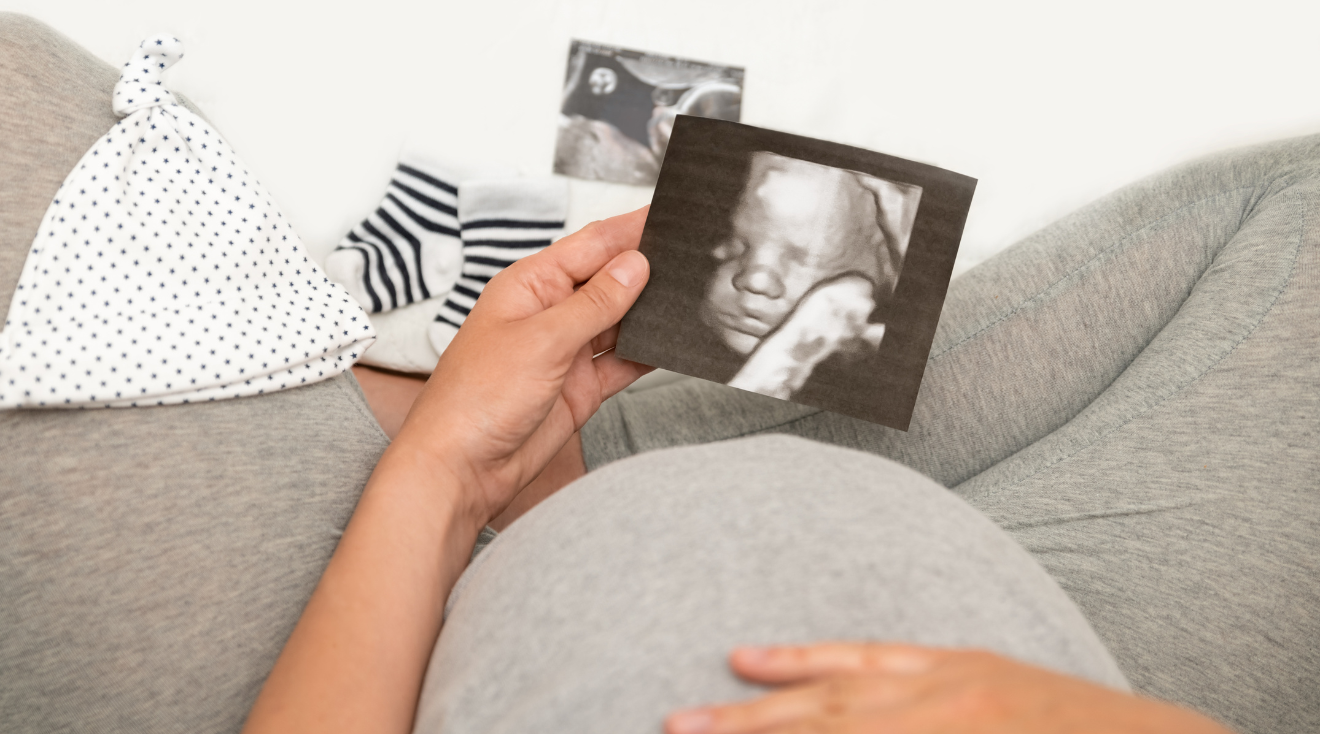 Dad's Hilarious Hack to See Who Baby Will Take After