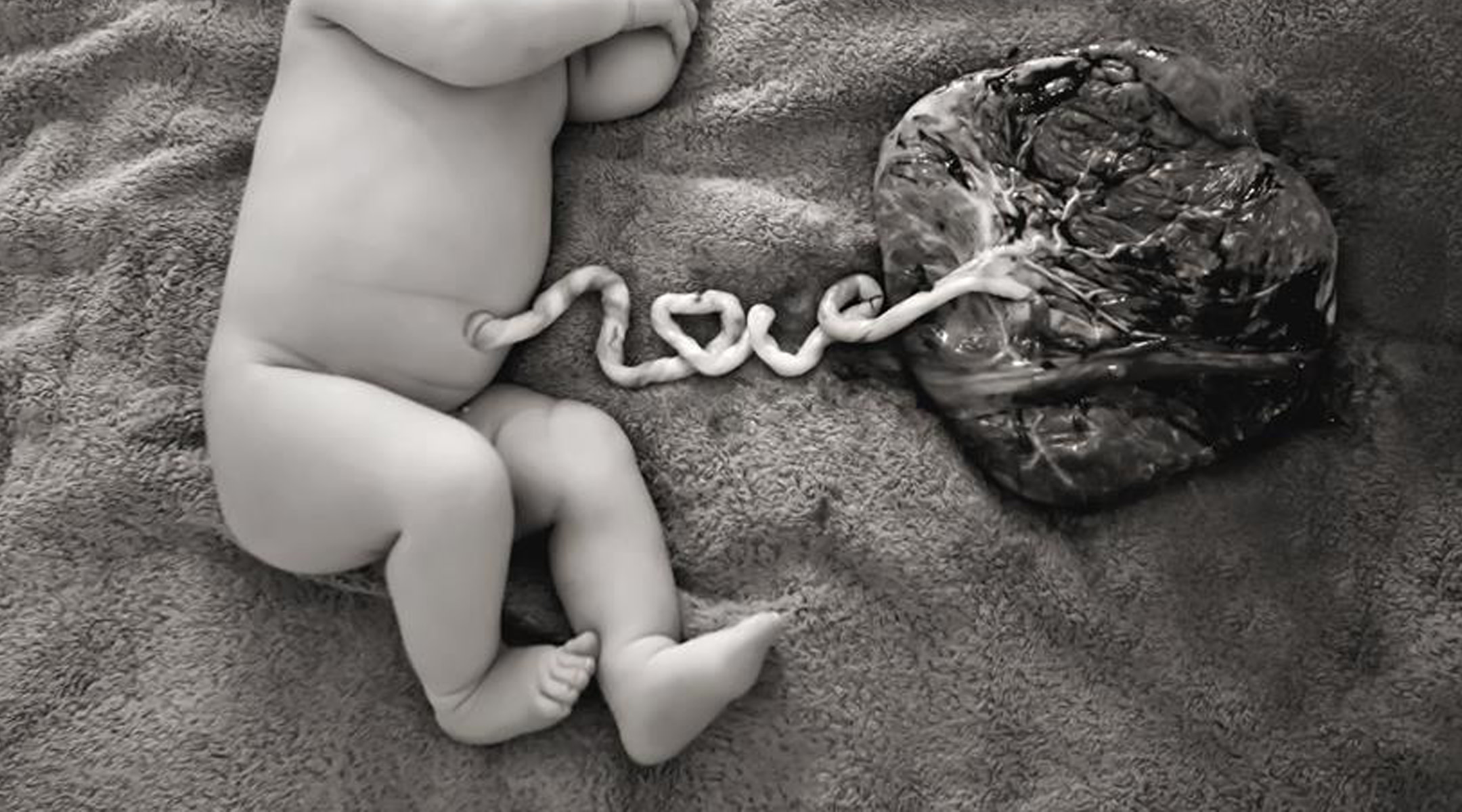 Newborn next to placenta with umbilical cord attached