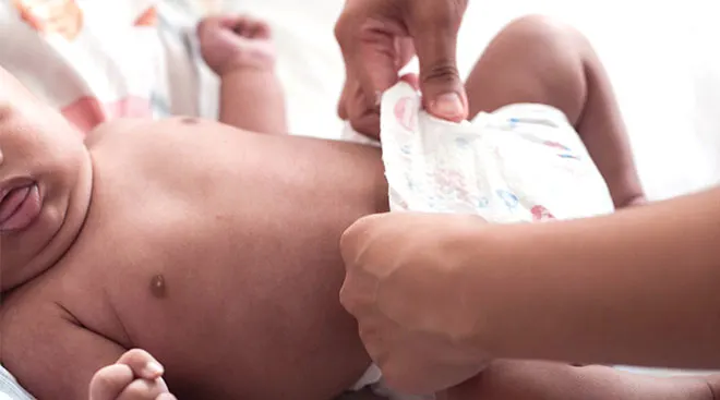 Pair of hands changing baby's diaper.