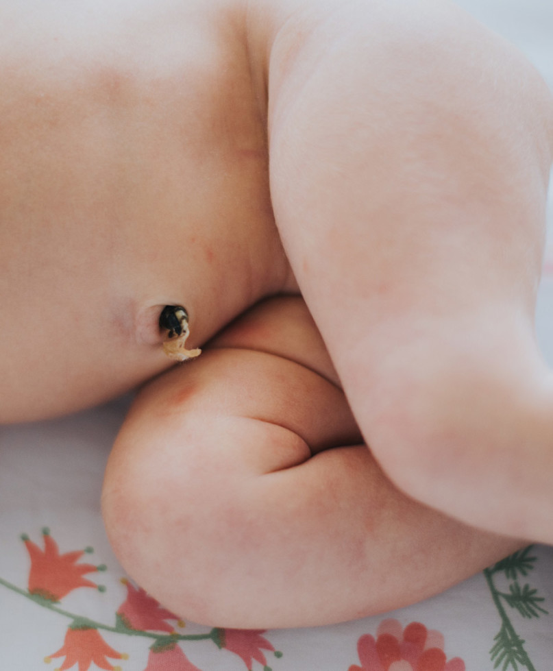 Expert Explains The Importance Of Umbilical Cord Care