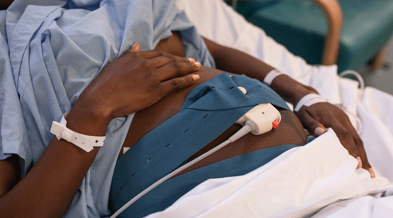 pregnant woman hooked up to monitors at hospital