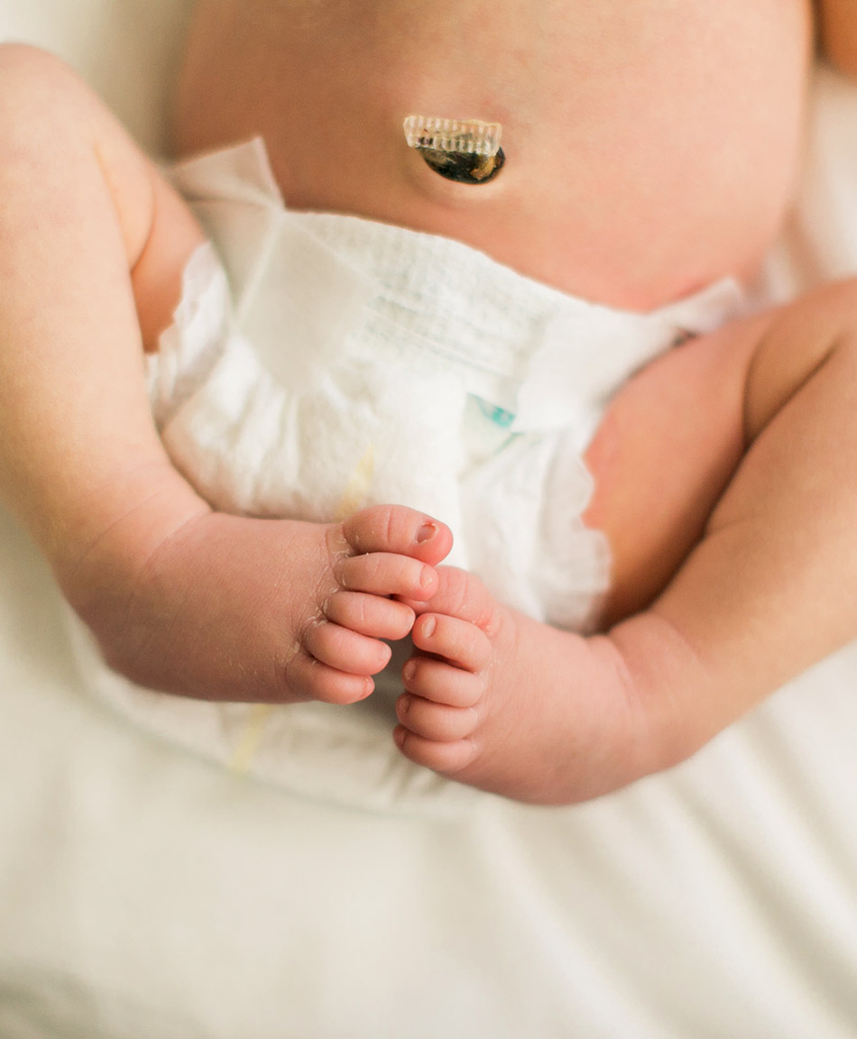 Newborn diapers with umbilical cord clearance cut out