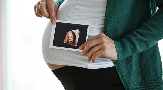 pregnant woman holding 3d ultrasound picture of baby