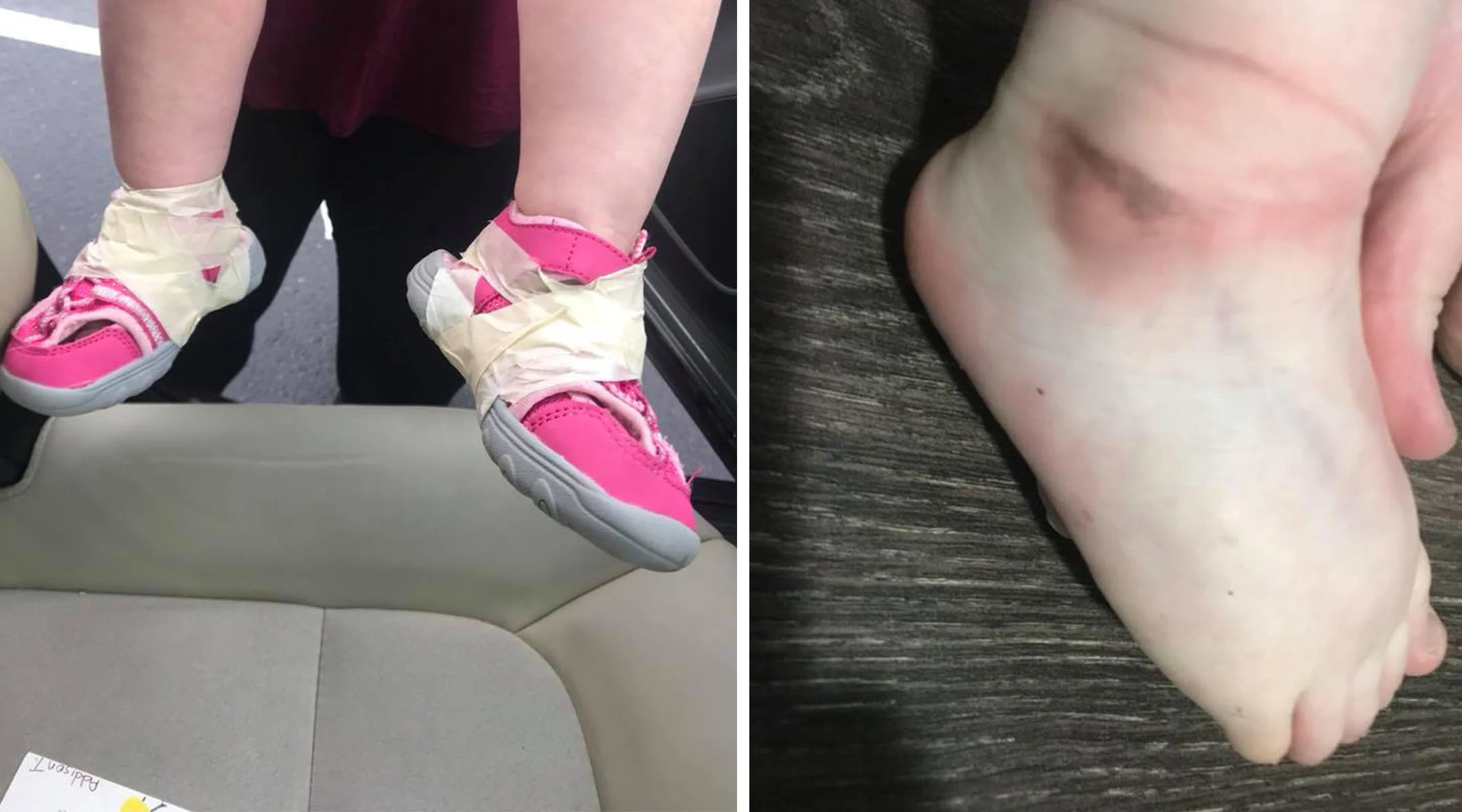 Day Care Tapes Shoes To Toddler's Ankles: How Would You React?