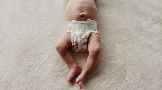 What to Know About Outie Belly Buttons in Babies