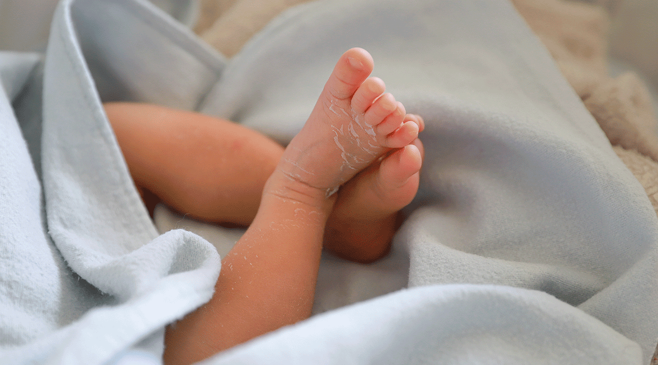 newborn baby with dry flaky skin on feet