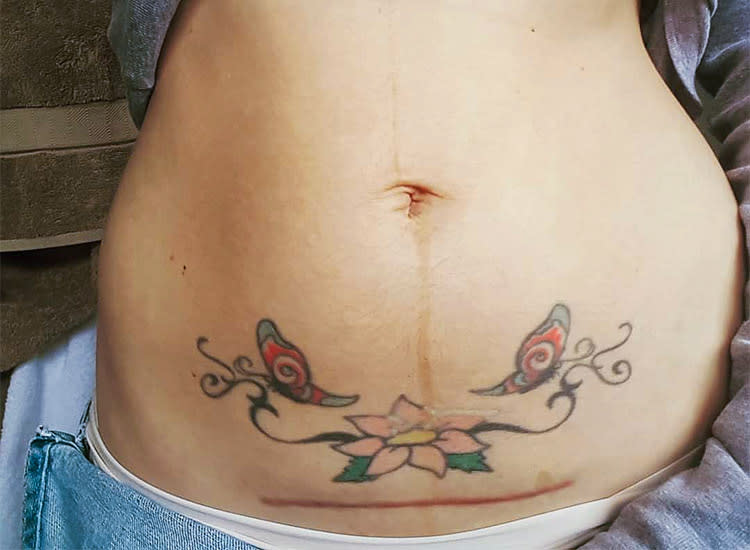 c-section-scar-mom-flower-tattoos