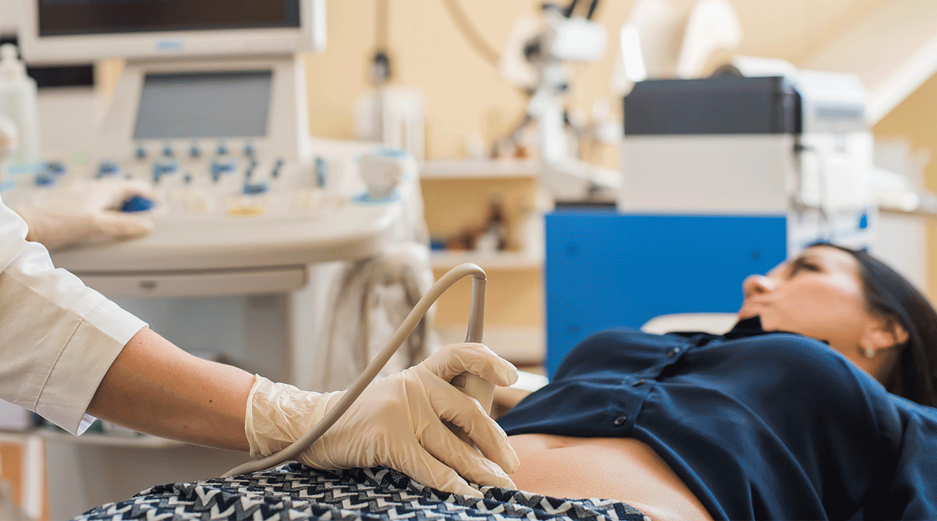 woman getting an ultrasound 