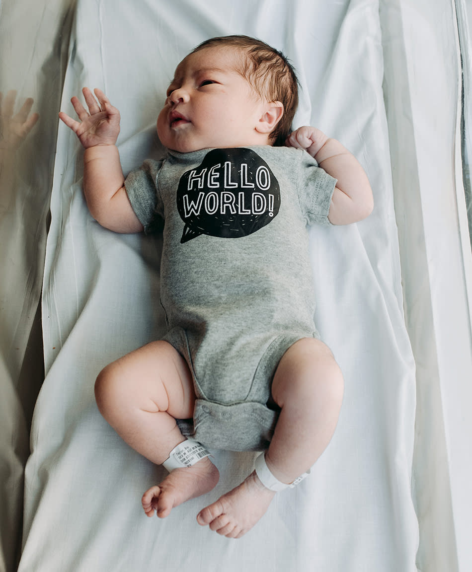 Shaken Baby Syndrome Causes And Symptoms