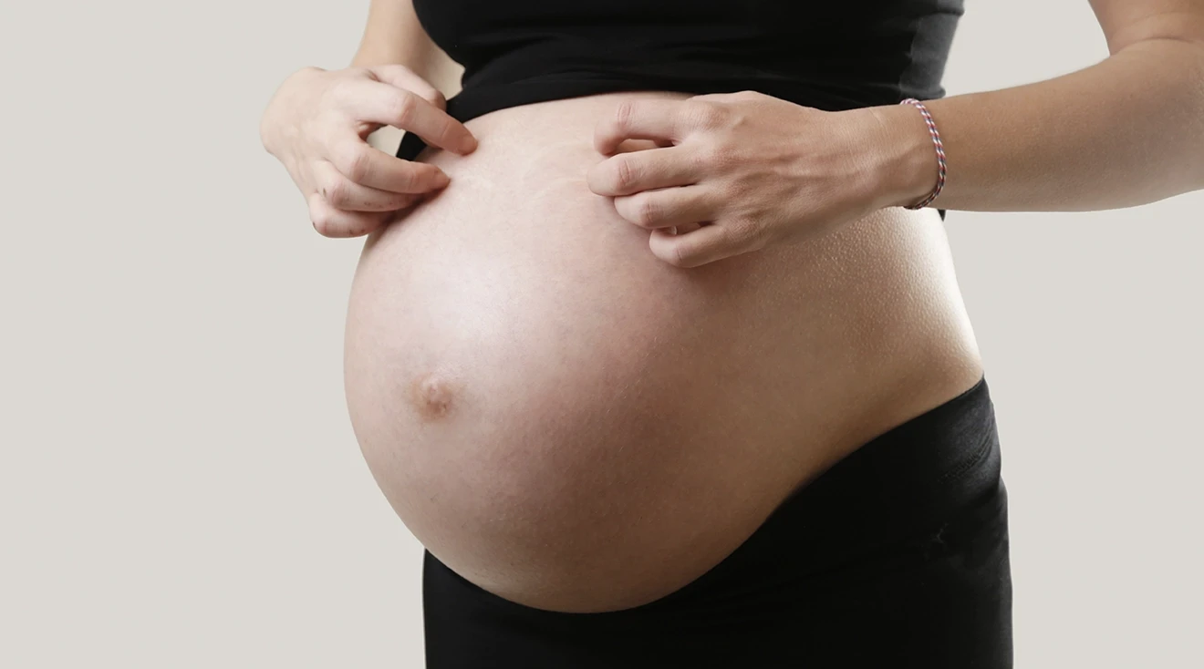 pregnant woman itching belly