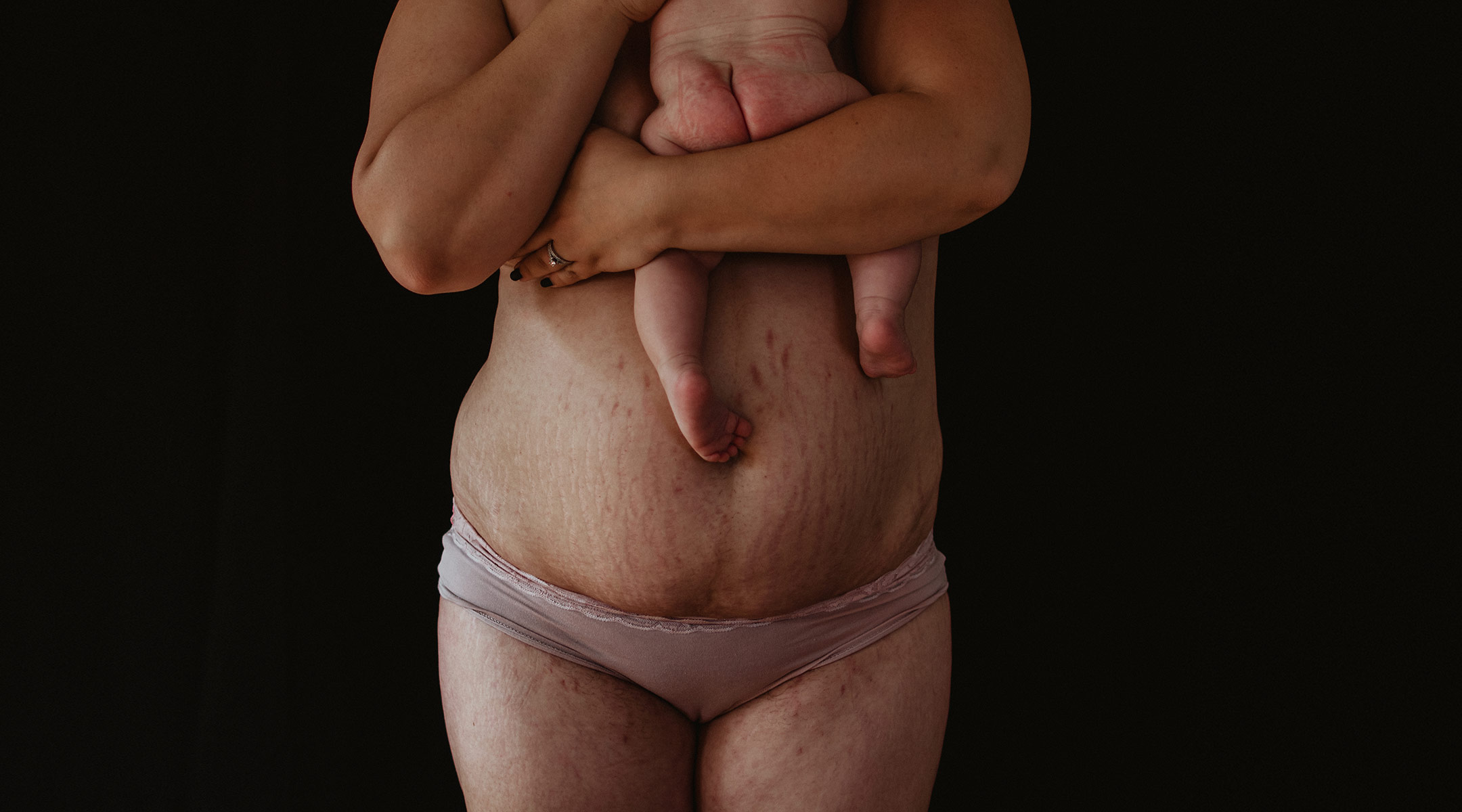 intimate photo series capturing postpartum bodies