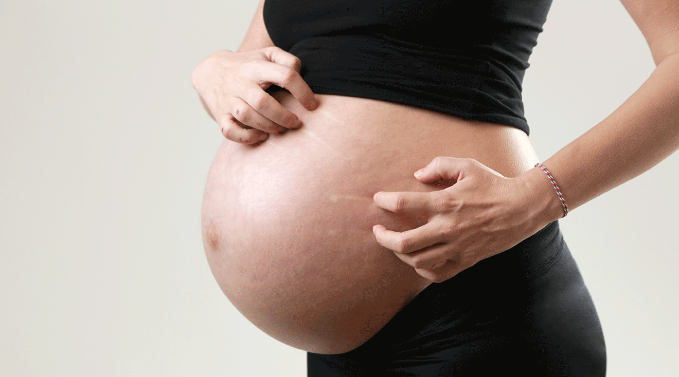 pregnant woman itching belly